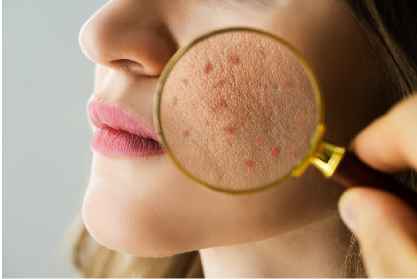 A Importância da Avaliação e Diagnóstico Estético da Pele: O Papel do Sistema Baumann e a Escolha dos Produtos para Uso em Casa