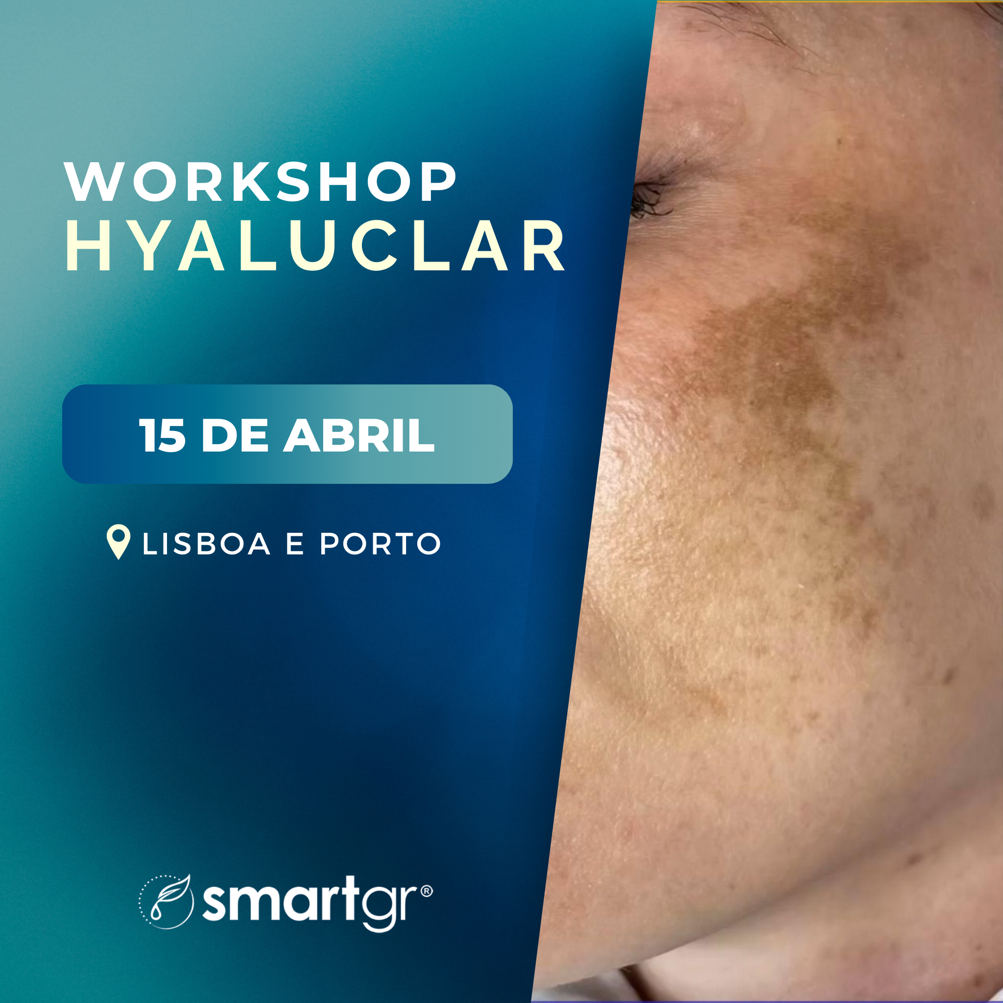 15 de Abril | Workshop Hyaluclar