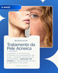 04 de Maio | Workshop Tratamento da pele Acneica