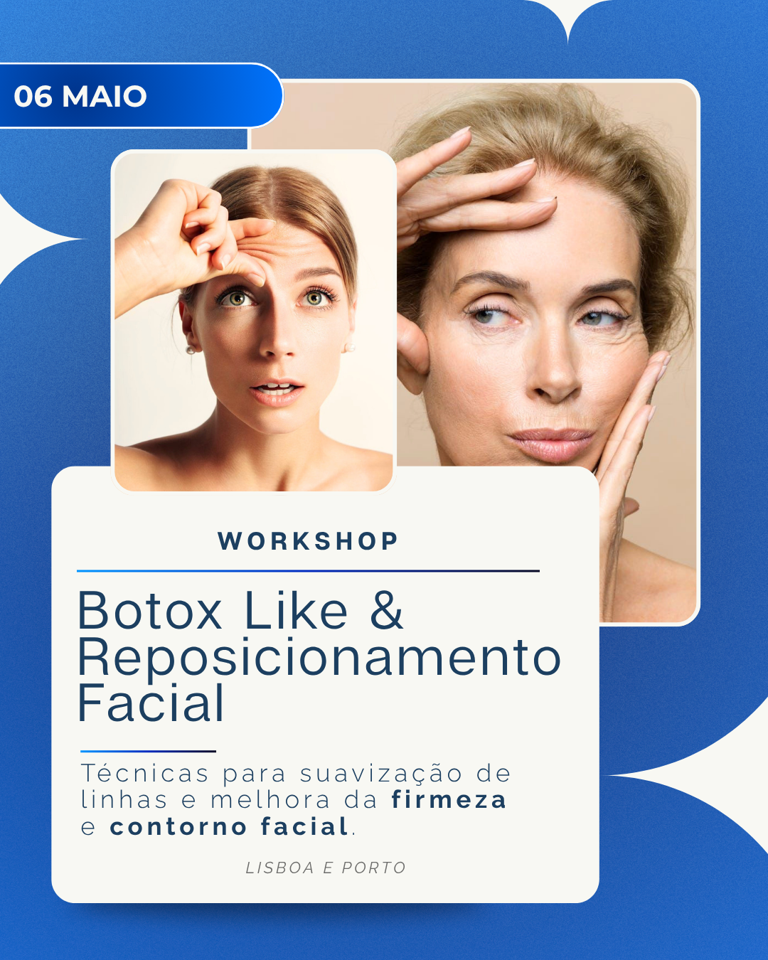 06 de Maio | Workshop Botox Like & Reposicionamento Facial